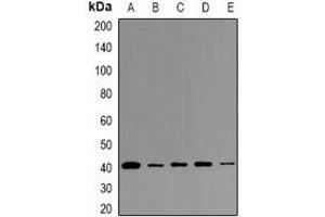 Western blot analysis of LPAAT gamma expression in K562 (A), A549 (B), PC12 (C), mouse testis (D), rat testis (E) whole cell lysates.
