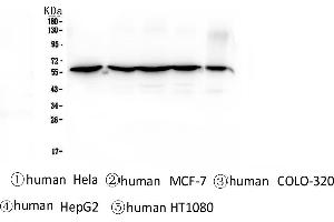 Western blot analysis of CCT3 using anti-CCT3 antibody .