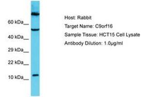 Image no. 1 for anti-Chromosome 9 Open Reading Frame 16 (C9orf16) (C-Term) antibody (ABIN6750667) (C9orf16 Antikörper  (C-Term))