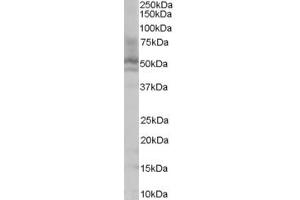 Western Blotting (WB) image for anti-Proline and Serine-Rich Protein 2 (PROSER2) (C-Term) antibody (ABIN2786271) (PROSER2 Antikörper  (C-Term))