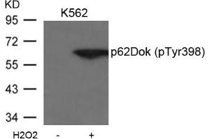 Western blot analysis of extracts from K562 cells untreated or treated with H2O2 using p62Dok(phospho-Tyr398) Antibody. (DOK1 Antikörper  (pTyr398))