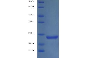 SDS-PAGE (SDS) image for Shiga Toxin Subunit B (STXB) (AA 21-89) protein (His-SUMO Tag) (ABIN5710672) (STXB Protein (AA 21-89) (His-SUMO Tag))