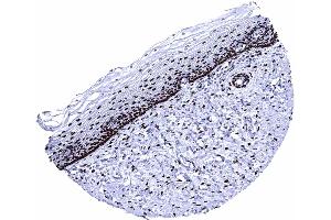 Uterus cervix An intense ER staining is seen in stromal cells and in the majority of squamous epithelial cells uf the uterine ectocervix