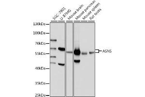 Western blot analysis of extracts of various cell lines, using ASNS antibody (ABIN7265693) at 1:1000 dilution. (Asparagine Synthetase Antikörper  (AA 262-561))