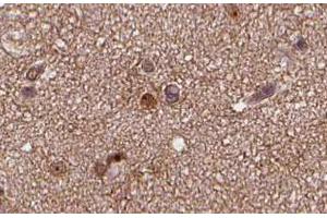 ABIN6266635 at 1/100 staining human brain tissue sections by IHC-P. (SNAP25 Antikörper  (C-Term))