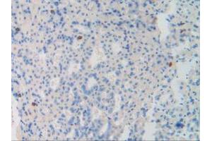 Figure. (Dynamin 1 Antikörper  (AA 572-745))