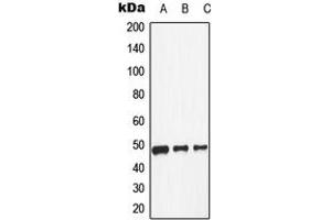 Western blot analysis of Dopamine Receptor D1 expression in HeLa (A), NIH3T3 (B), H9C2 (C) whole cell lysates. (Dopamine Receptor d1 Antikörper  (Center))