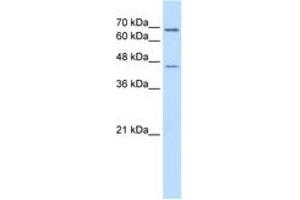 Image no. 2 for anti-Aldehyde Dehydrogenase 3 Family, Member A2 (ALDH3A2) (AA 351-400) antibody (ABIN6736668) (ALDH3A2 Antikörper  (AA 351-400))