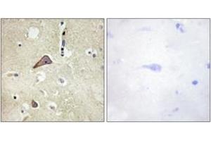 Immunohistochemistry analysis of paraffin-embedded human brain, using NMDAR1 (Phospho-Ser896) Antibody. (GRIN1/NMDAR1 Antikörper  (pSer897))