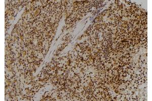 ABIN6274773 at 1/100 staining Rat spleen tissue by IHC-P. (RPL23 Antikörper  (C-Term))