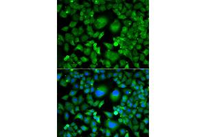 Immunofluorescence analysis of A549 cell using UBE2H antibody. (UBE2H Antikörper)