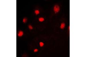 Immunofluorescent analysis of MCM2 staining in Jurkat cells. (MCM2 Antikörper  (N-Term))