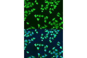 Immunofluorescence analysis of U2OS cells using SMN2 antibody.
