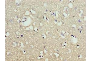 Immunohistochemistry of paraffin-embedded human brain tissue using ABIN7165209 at dilution of 1:100 (CNIH2 Antikörper  (AA 94-138))