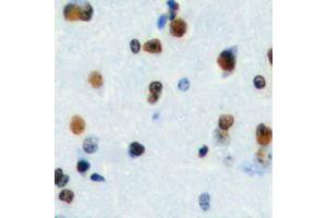 Immunohistochemical analysis of HEN1/2 staining in human brain formalin fixed paraffin embedded tissue section. (HEN1/2 (Center) Antikörper)