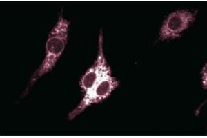 Immunofluorescent staining of Mouse Macrophages.