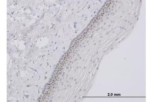 Immunoperoxidase of monoclonal antibody to TFAP4 on formalin-fixed paraffin-embedded human uterine cervix. (TFAP4 Antikörper  (AA 93-192))