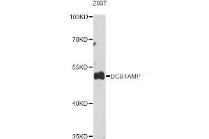 Western blot analysis of extracts of various cell lines, using DCSTAMP antibody (ABIN6293906) at 1:1000 dilution. (Transmembrane 7 Superfamily Member 4 (TM7SF4) Antikörper)