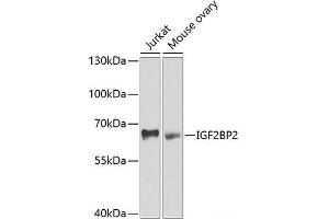 Western blot analysis of extracts of various cell lines using IGF2BP2 Polyclonal Antibody at dilution of 1:1000. (IGF2BP2 Antikörper)