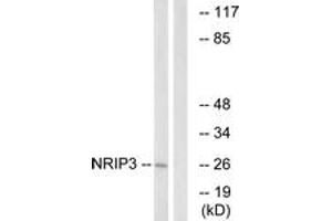 Western blot analysis of extracts from COLO cells, using NRIP3 Antibody. (NRIP3 Antikörper  (AA 192-241))
