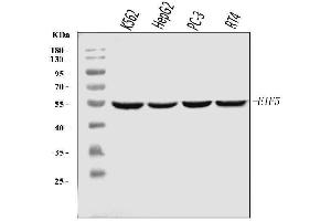 Western blot analysis of EIF5 using anti-EIF5 antibody (ABIN7599721).