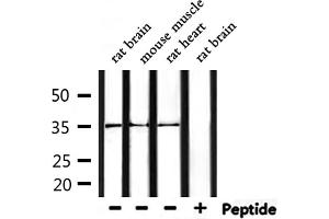 Western blot analysis of extracts from mouse muscle and rat brain and rat heart, using OR52R1 Antibody. (OR52R1 Antikörper)