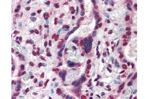 Anti-ATF6 antibody IHC of human placenta.