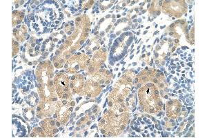 KHK antibody was used for immunohistochemistry at a concentration of 4-8 ug/ml to stain Epithelial cells of renal tubule (arrows) in Human Kidney. (Ketohexokinase Antikörper)