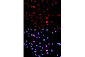 Immunofluorescence (IF) image for anti-Structural Maintenance of Chromosomes 1A (SMC1A) (pSer957) antibody (ABIN3019554) (SMC1A Antikörper  (pSer957))
