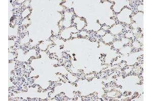 Immunohistochemistry (IHC) image for anti-Eukaryotic Translation Initiation Factor 4A2 (EIF4A2) antibody (ABIN1876482) (EIF4A2 Antikörper)