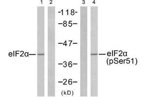 Western blot analysis of extracts from K562 cells untreated or treated with IFN-α (100ng/ml, 20min), using eIF2α (Ab-51) antibody (E021271, Lane 1 and 2) and eIF2α (phospho-Ser51) antibody (E011279, Lane 3 and 4). (EIF2A Antikörper  (pSer51))
