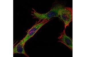 Immunofluorescence analysis of NIH/3T3 cells using HK1 antibody (green).