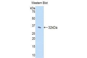 Western Blotting (WB) image for anti-Janus Kinase 2 (JAK2) (AA 120-367) antibody (ABIN1176454) (JAK2 Antikörper  (AA 120-367))