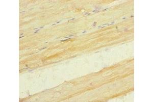 Immunohistochemistry of paraffin-embedded human skeletal muscle tissue using ABIN7169347 at dilution of 1:100