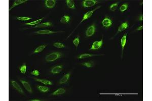 Immunofluorescence of purified MaxPab antibody to RPN2 on HeLa cell. (Ribophorin II Antikörper  (AA 1-631))