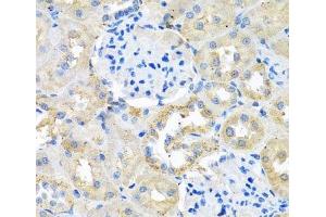 Immunohistochemistry of paraffin-embedded Rat kidney using COTL1 Polyclonal Antibody at dilution of 1:100 (40x lens).