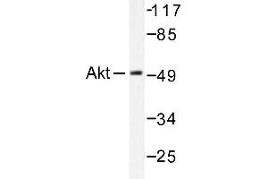 Image no. 1 for anti-V-Akt Murine Thymoma Viral Oncogene Homolog 1 (AKT1) antibody (ABIN265304) (AKT1 Antikörper)