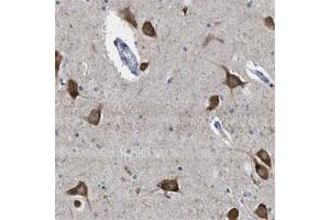 Immunohistochemical staining of human hippocampus shows strong cytoplasmic positivity in neuronal cells. (YARS Antikörper)