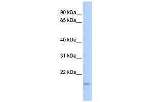 TNFAIP8L1 antibody used at 1 ug/ml to detect target protein. (TNFAIP8L1 Antikörper  (Middle Region))