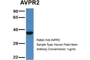 Host: Rabbit  Target Name: AVPR2  Sample Tissue: Human Fetal Heart  Antibody Dilution: 1. (AVPR2 Antikörper  (C-Term))