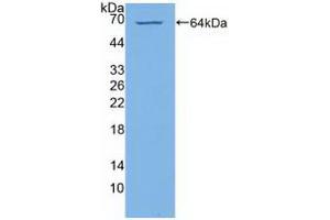 Western blot analysis of recombinant Human PI4Ka. (PI4KA Antikörper  (AA 1-300))