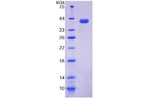 SDS-PAGE analysis of Human NAP1L1 Protein.