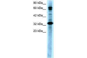WB Suggested Anti-MAP3K7IP2 Antibody Titration:  0.