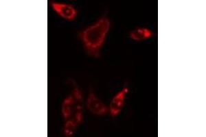 ABIN6275852 staining HuvEc cells by IF/ICC. (PHKG1 Antikörper  (Internal Region))