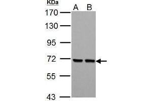 WB Image PCK2 antibody [C1C2], Internal detects PCK2 protein by Western blot analysis. (PEPCK Antikörper)