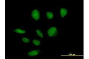 Immunofluorescence of purified MaxPab antibody to ZBTB39 on HeLa cell. (ZBTB39 Antikörper  (AA 1-712))