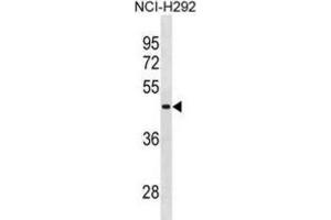 Western Blotting (WB) image for anti-RNA Binding Motif Protein, Y-Linked Family 1 Member A1 (RBMY1A1) antibody (ABIN2995181) (RBMY1A1 Antikörper)