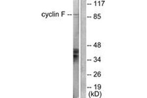 Western Blotting (WB) image for anti-Cyclin F (CCNF) (AA 737-786) antibody (ABIN2889181) (Cyclin F Antikörper  (AA 737-786))