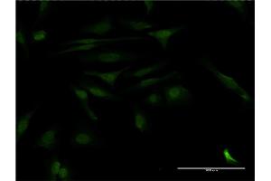 Immunofluorescence of monoclonal antibody to CALCOCO2 on HeLa cell.