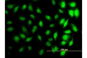 Immunofluorescence of monoclonal antibody to HIST1H3D on HeLa cell. (HIST1H3D Antikörper  (AA 1-60))